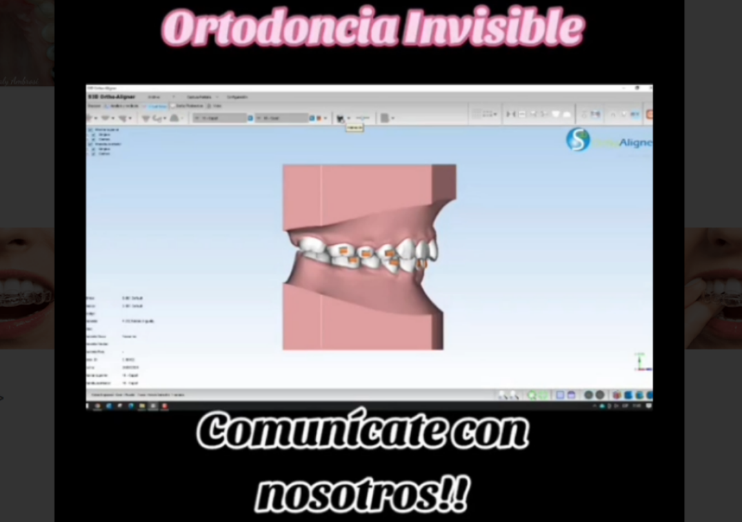 Video testimonio 6