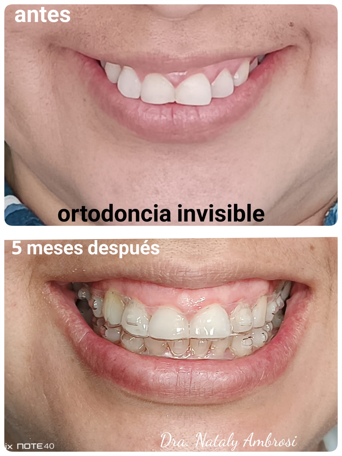 Antes y después - Caso 1