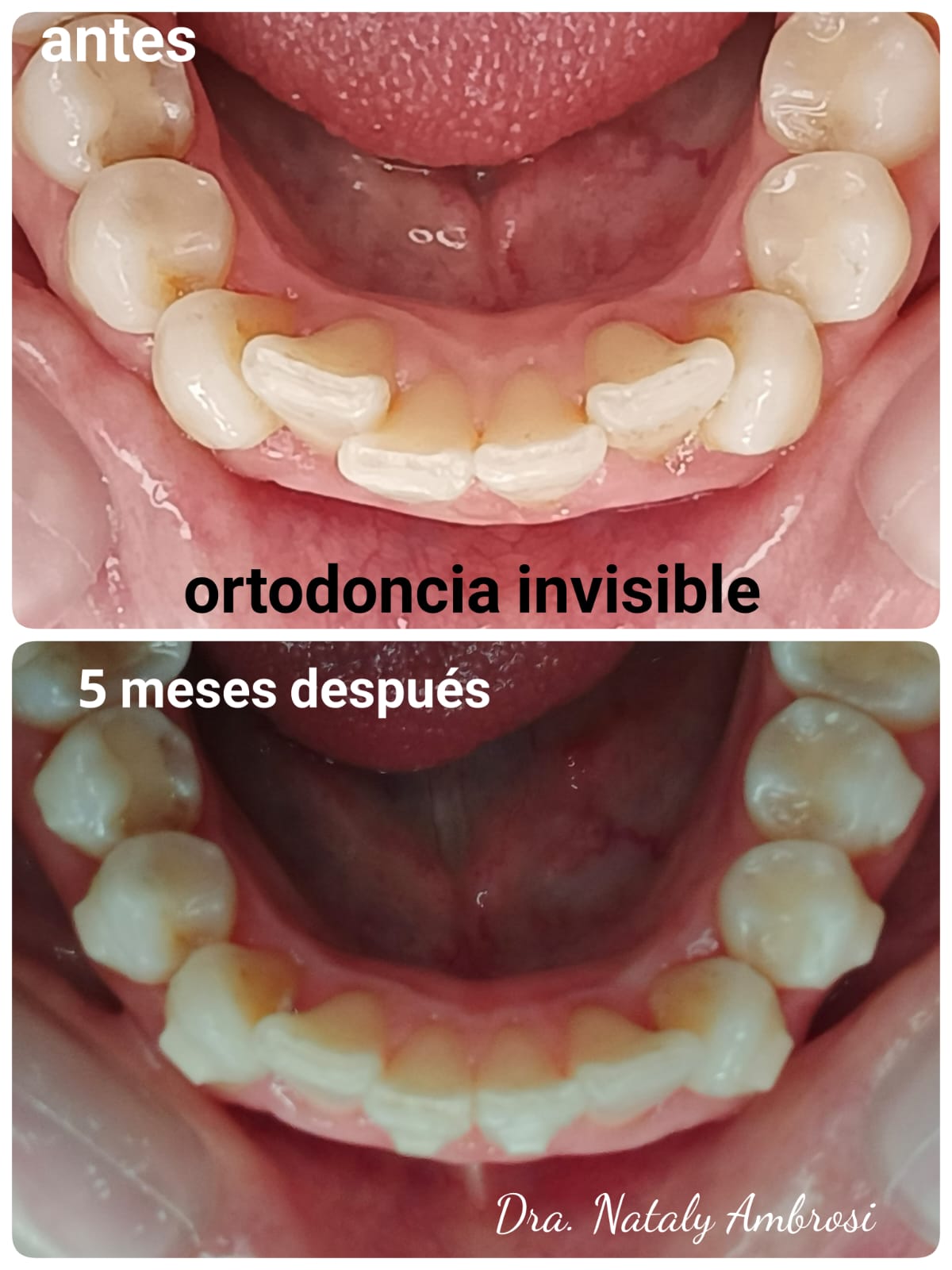 Antes y después - Caso 3