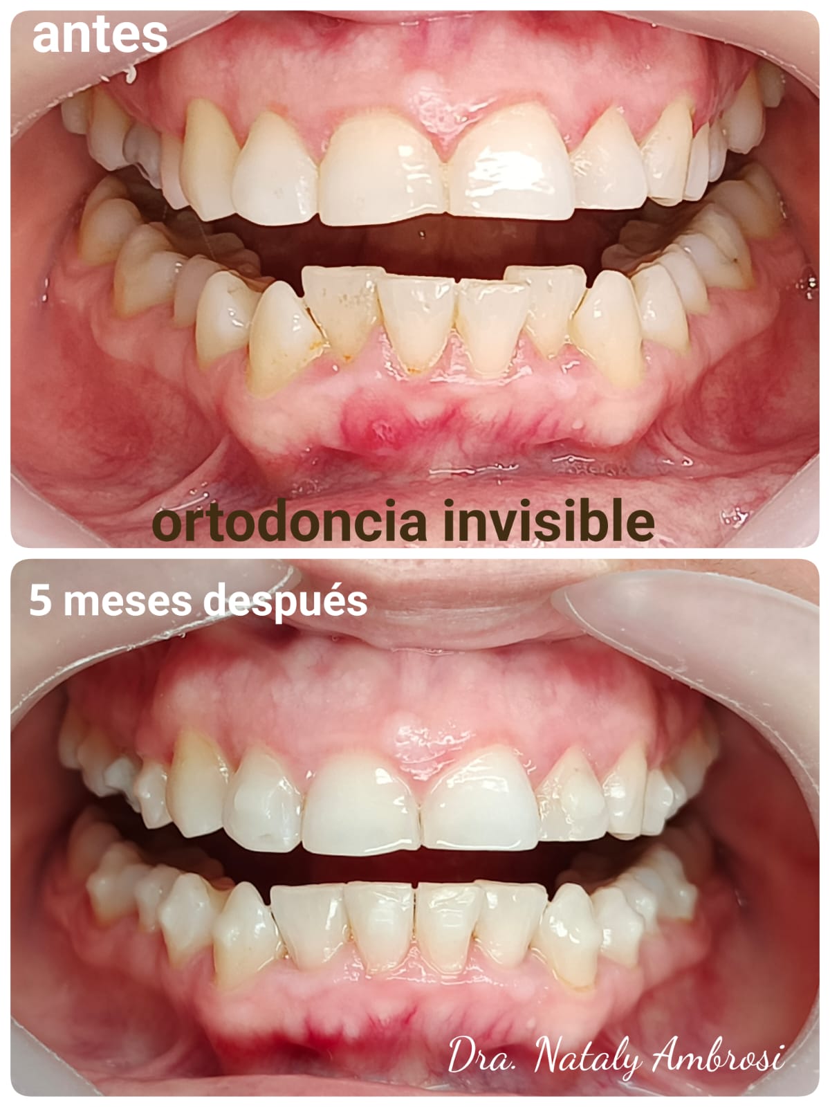 Antes y después - Caso 2