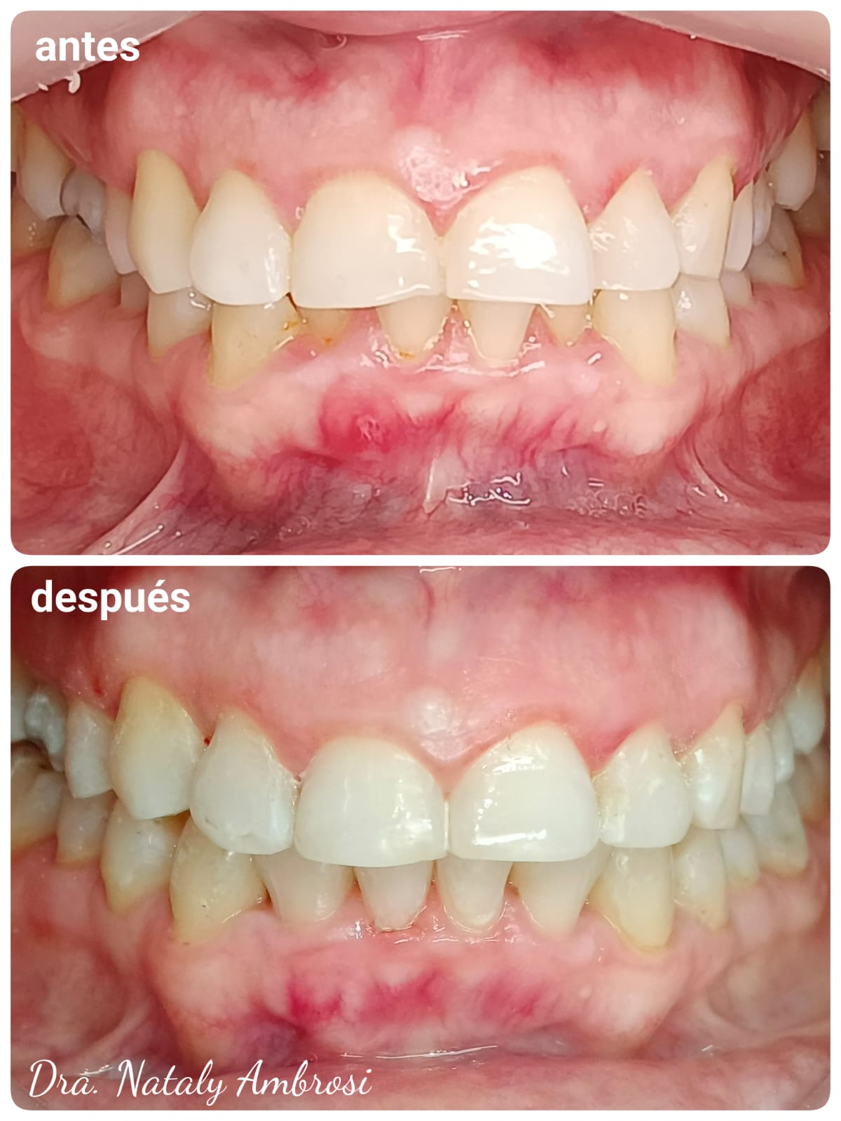 Antes y después - Caso 2