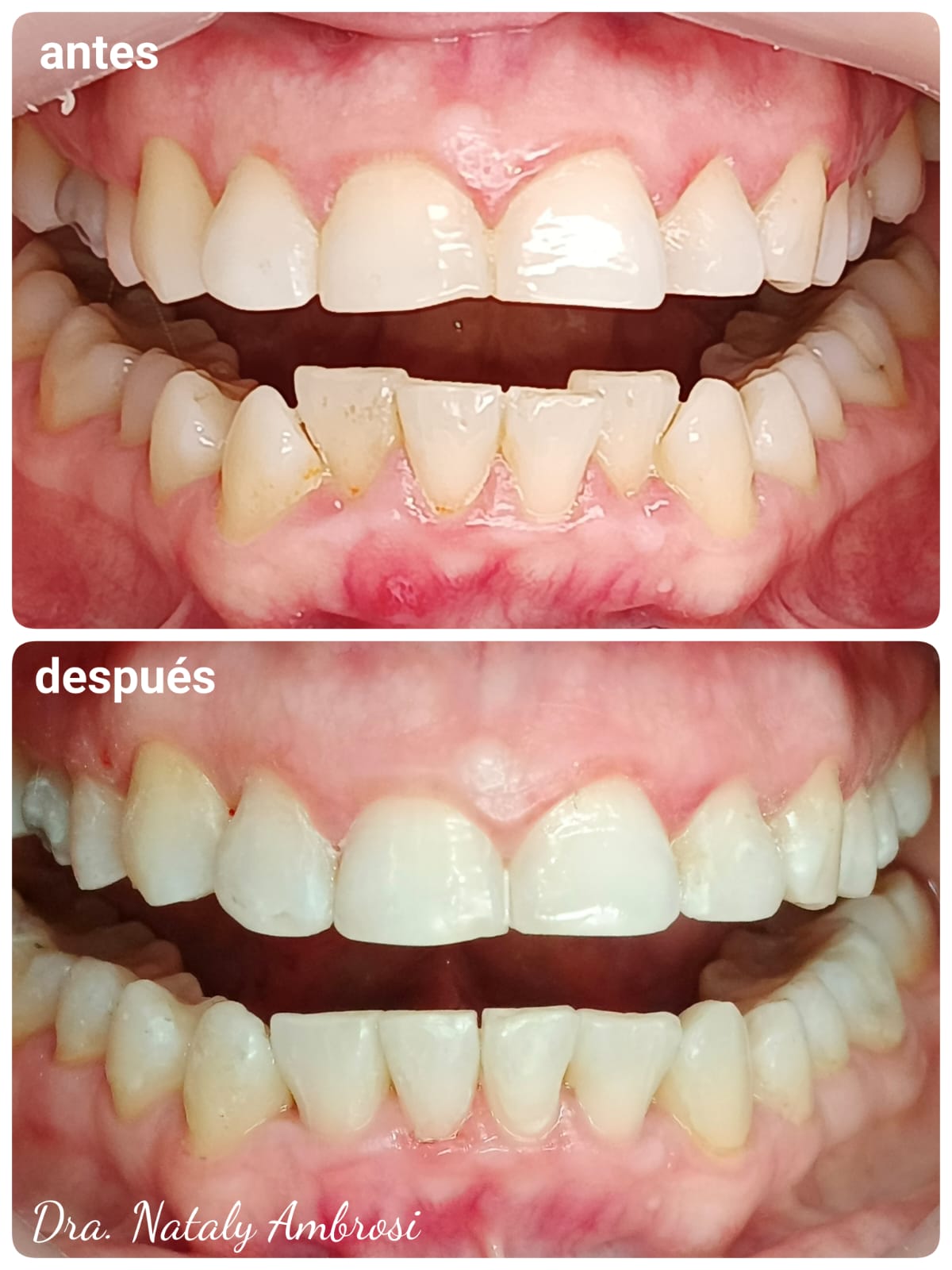 Antes y después - Caso 3